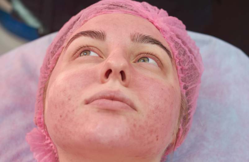 Quelle est l'espérance de vie avec un lupus érythémateux disséminé ?